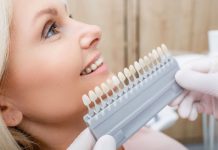 Ce sunt fațetele dentare și cum funcționează?